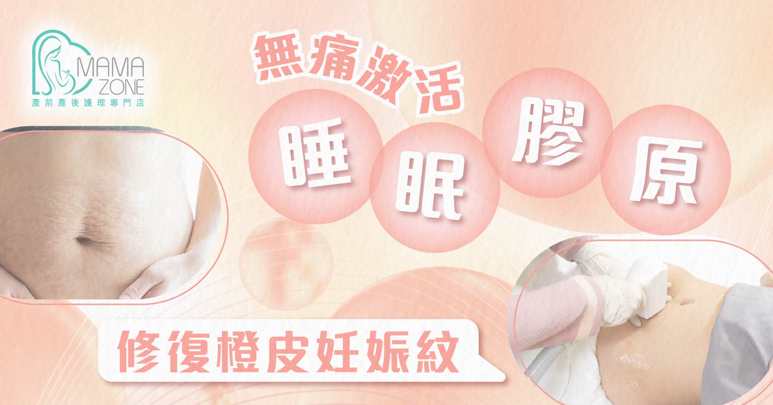 橙皮妊娠紋